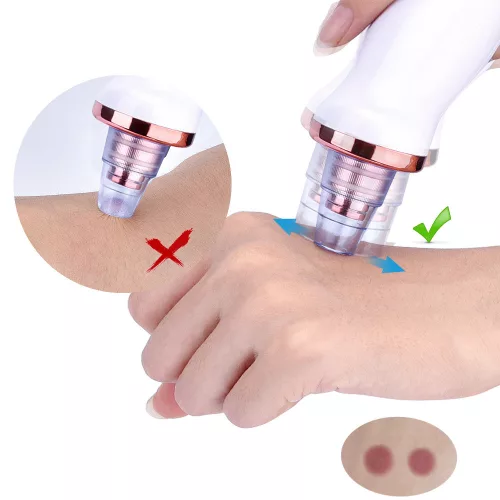 Aspirator facial Y08, ingrijire ten, indepartarea punctelor negre, minimizarea porilor, portabil, alb