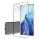 Husa de protecție Xiaomi Mi 11 Lite, protectie camera, TPU transparent, grosime 2 mm